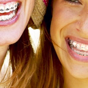 Ortodoncia Fija con Brackets Estéticos de Zafiro en Barcelona